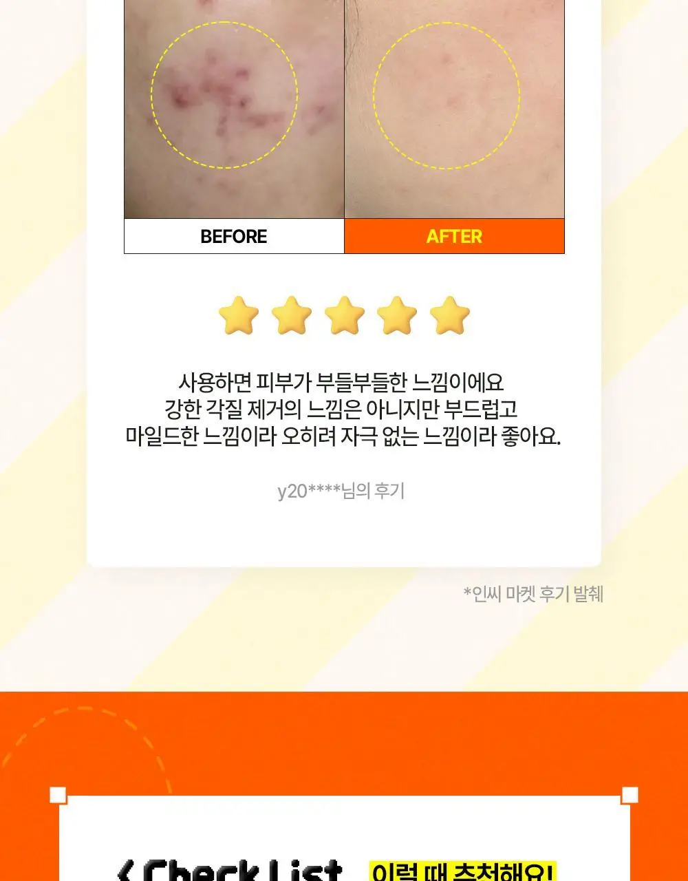 [온라인 단독] 파파레서피 블레미쉬 효소 파우더 클렌저 50g 더블기획 (+브러쉬+블레미쉬 크림 7ml) 상세페이지 8